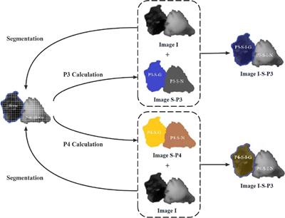 A polarization image enhancement method for glioma